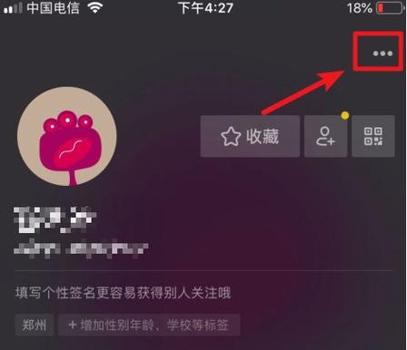 开了抖音小店还能开橱窗吗图标