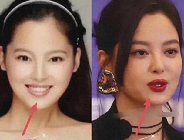 辛芷蕾的嘴唇叫什么唇