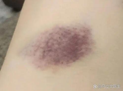 一觉醒来手上有铁锈色印记图标
