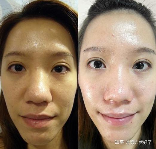 女生脸色暗黄怎么调理图标