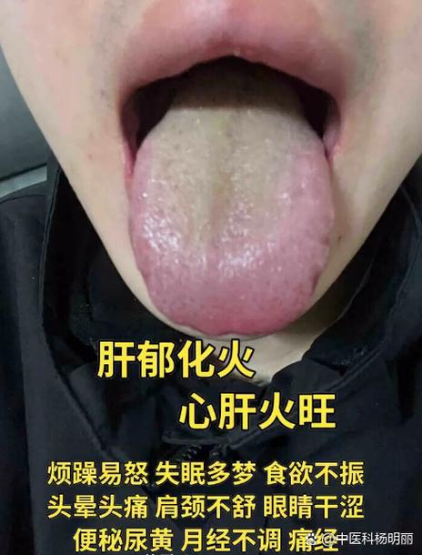 嘴巴里干喝水还是干还尿频