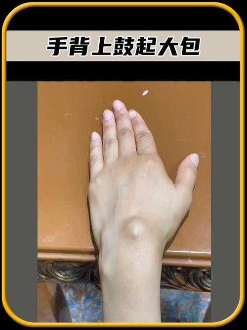 鼓大包的一定是女孩吗图标