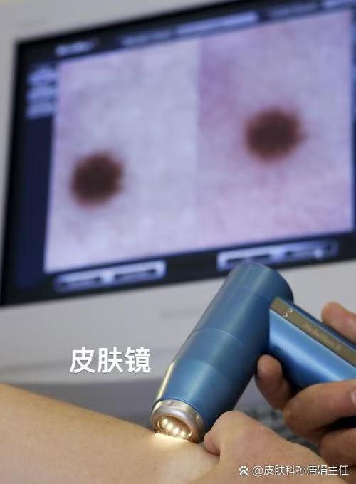 屏幕有白色斑块
