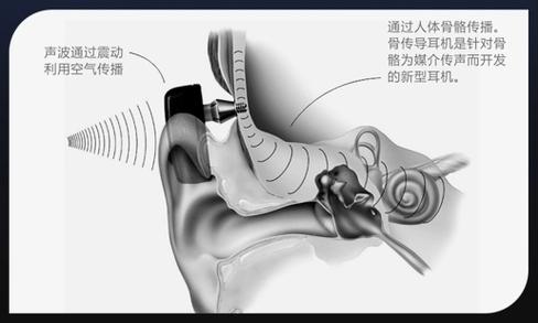 耳机会导致听力受损吗图标