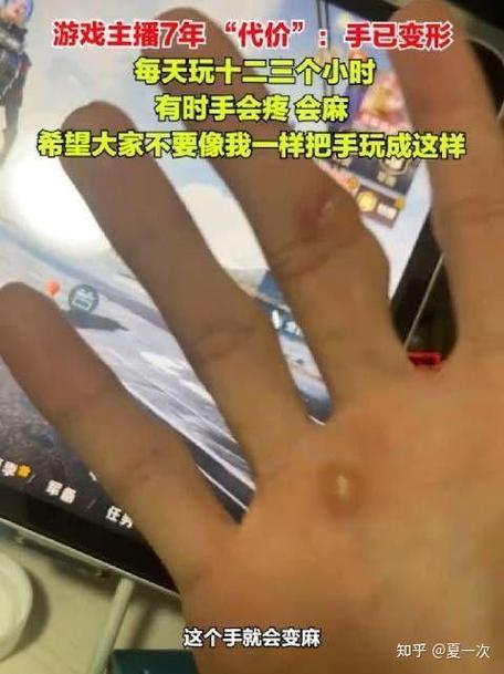 手指玩游戏变形了怎么办图标