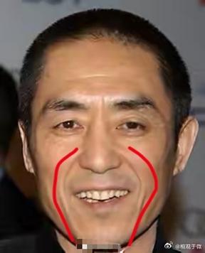 法令纹