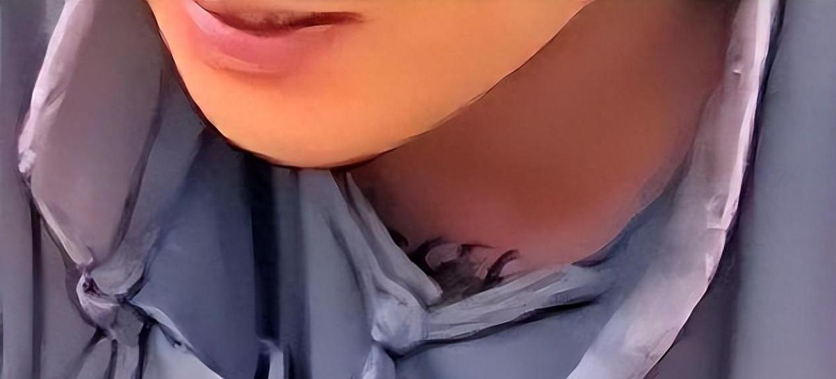 有纹身可以参加民兵吗