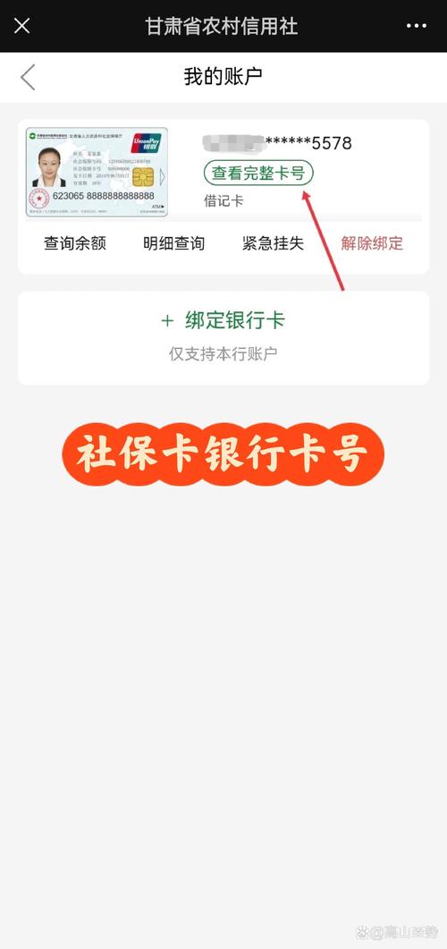 社保卡怎么查绑定的银行卡