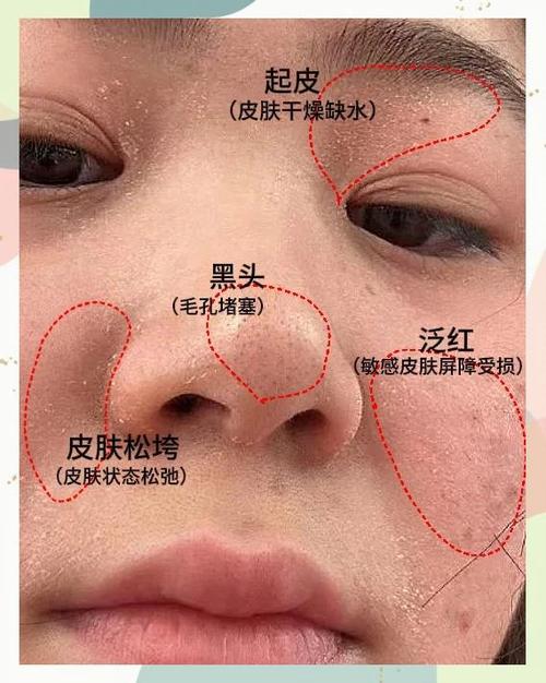 脸皮肤起皮是什么原因图标