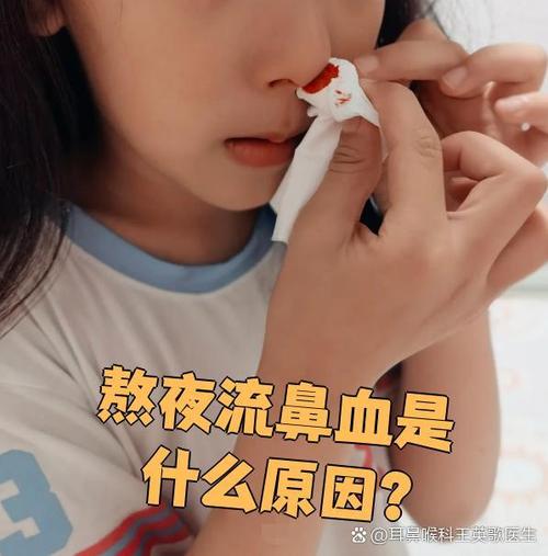 熬夜第二天早上流鼻血