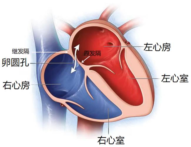卵圆孔与房间隔的位置图标