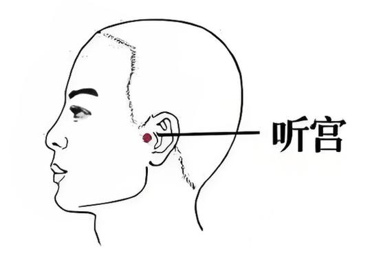 耳朵有声响怎么办图标