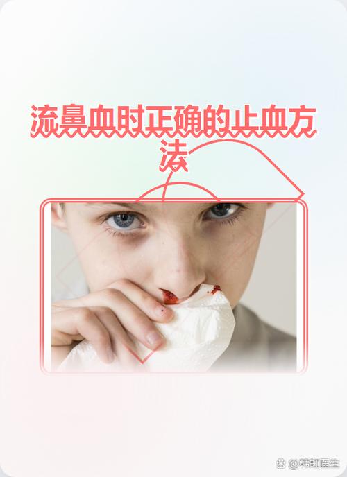 隔一段时间就流鼻血怎么回事图标