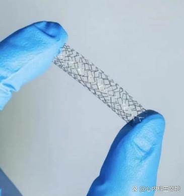 心脏能放多少个支架图标