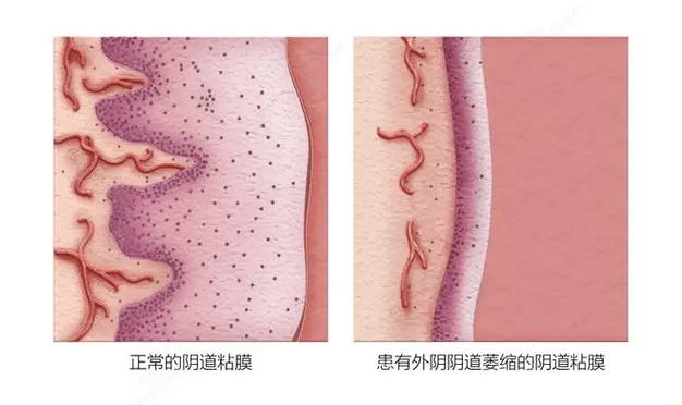 怎么查看私密相册