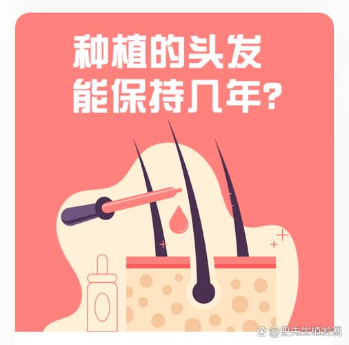 植发还会掉吗维持多久图标