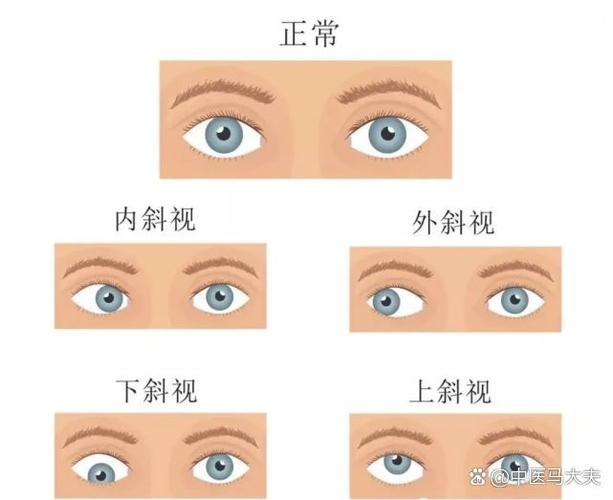 偏斜