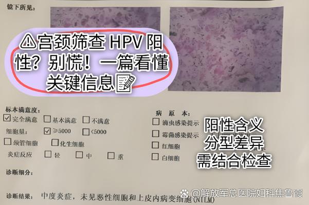 fish阴性好还是阳性好图标