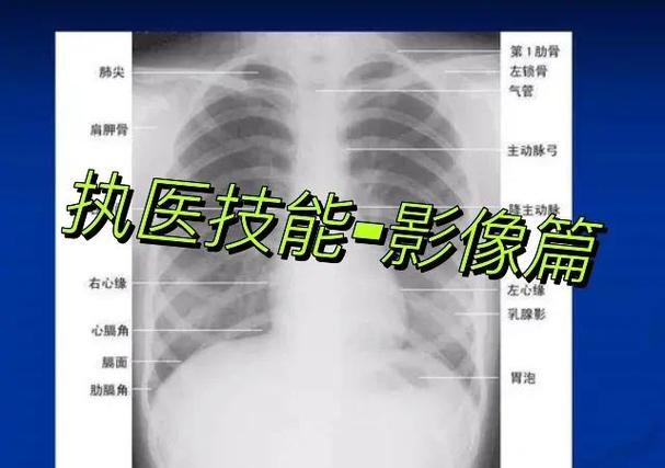 瓦怎么关x光图标