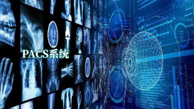 pacs的主要功能