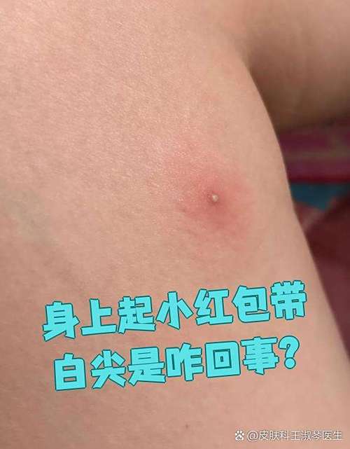胸口小红包越来越多