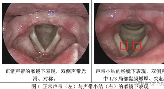 普通人怎么开嗓子图标