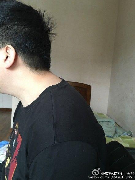 脖子往前伸图片