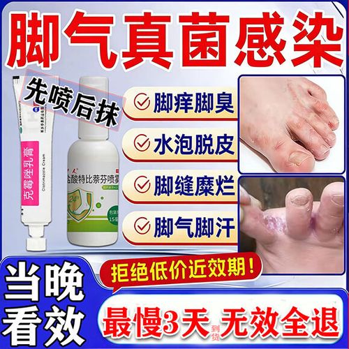 脚气烂脚趾缝痒溃烂怎样治疗图标