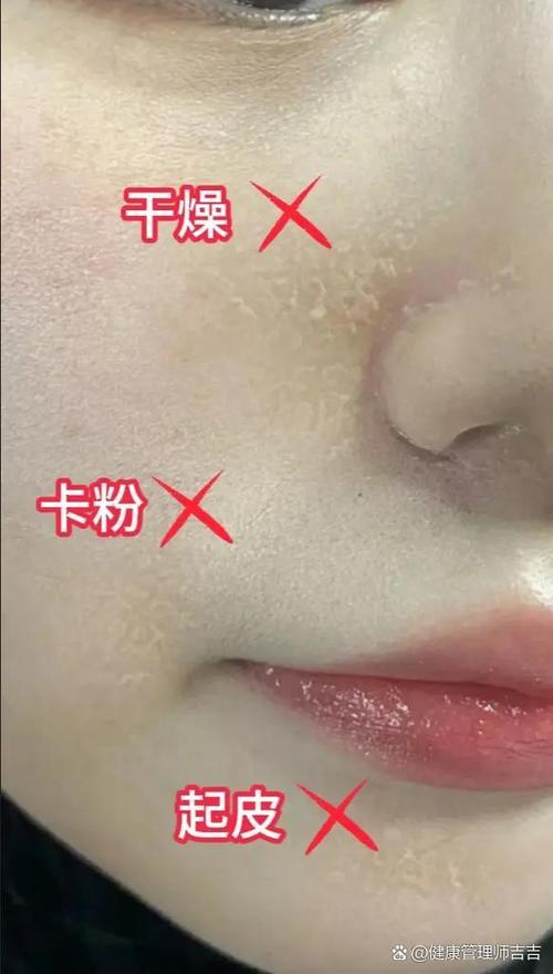 化妆后卡粉起皮如何补救图标