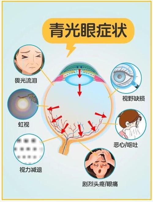 青光眼是怎么造成的