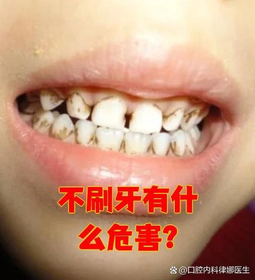 不刷牙影响做碳13吗图标
