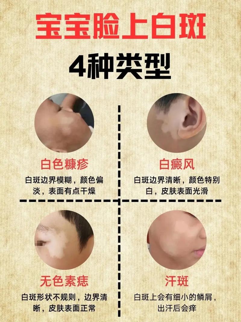 皮肤起白斑点是什么原因