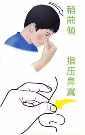 艾滋病患者流鼻血是什么预兆