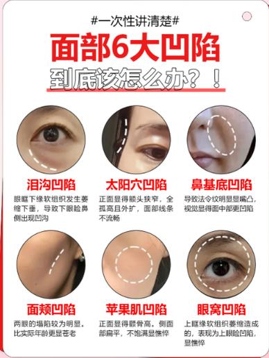 上眼皮凹陷怎么恢复饱满图标