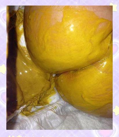 总是想拉稀又只拉一点