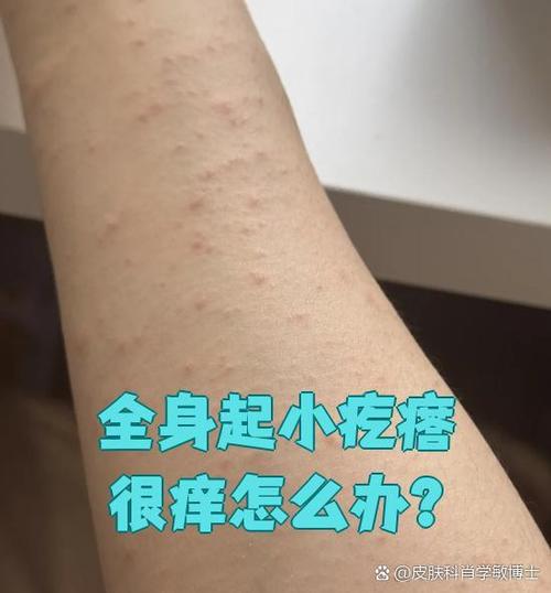 一身皮肤痒是什么原因