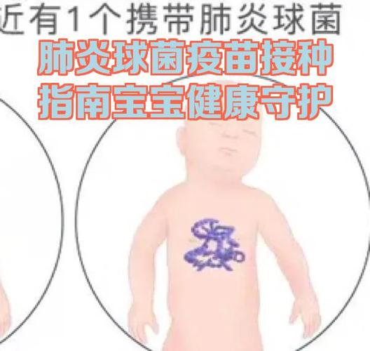 肺炎疫苗多少钱一针