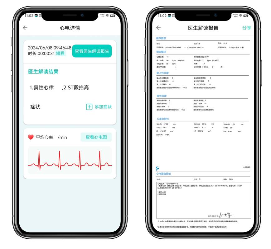 什么软件可以看心电图