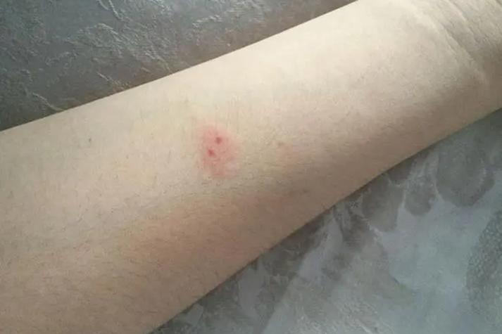 被蜈蚣咬代表什么预兆