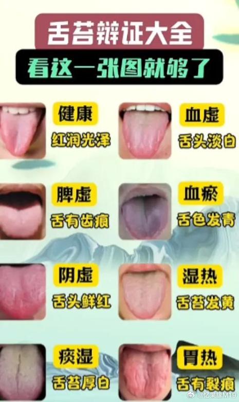 舌头上的鹅口疮图片