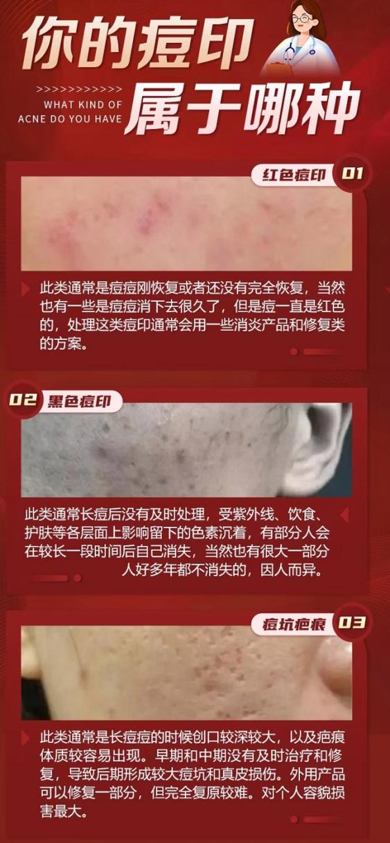 红色痘印消退的过程图标