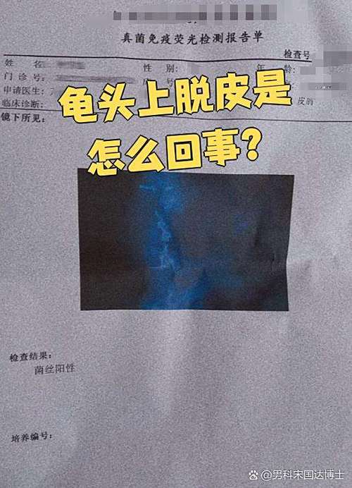 龟壳脱皮是什么原因