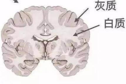 脑白质病变1级严重吗