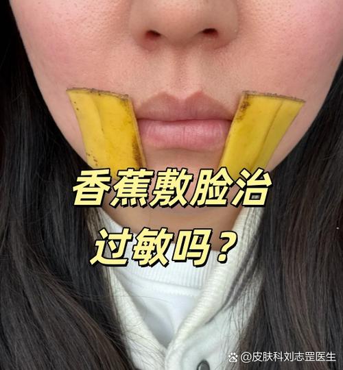 脸过敏敷香蕉有点疼