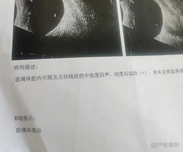 每次眨眼都有黑影闪一下图标