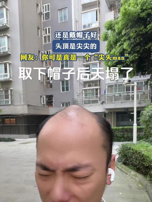 头顶尖的男人要警惕图标