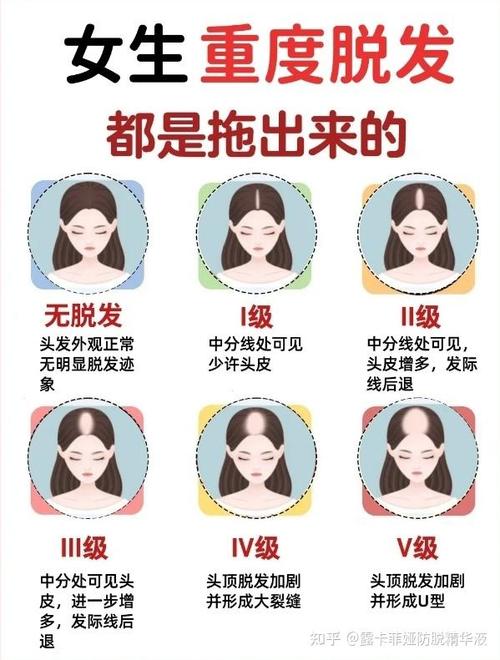 严重脱发咋回事?怎样调理?