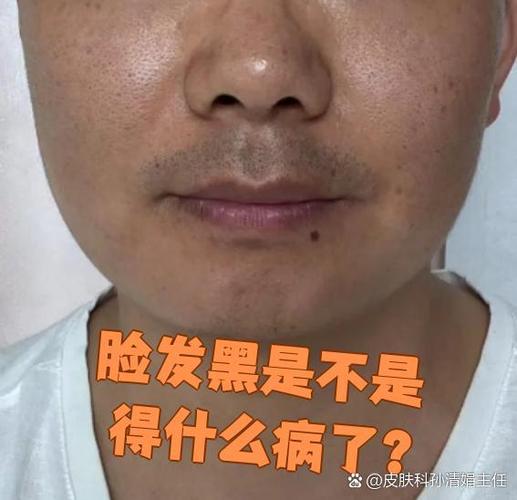 脸突然发黑是哪里出了问题