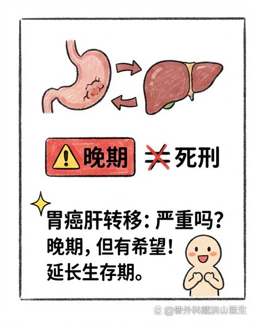 只要转移的都是晚期吗图标