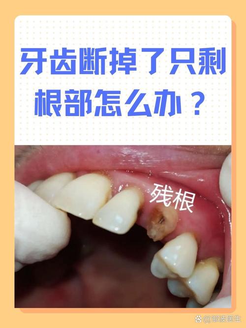 快牙容易断开图标